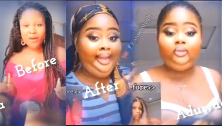 I Now Look Like A Roasted Pig – Lady Threatens Arrest As Hips Enlargement Product Ruins Her Beauty